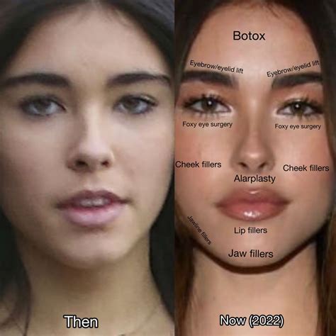 Did Madison Beer Have Plastic Surgery? Exploring the Intricacies of Celebrity Transformations